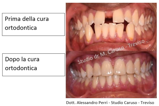 Studio Dentistico Caruso odontoiatria di qualit Treviso PG