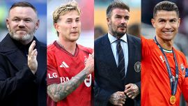 Calciatori e 'ritocchi', i campioni prima e dopo il chirurgo: da Ronaldo a Bernardeschi, Beckham e molti altri