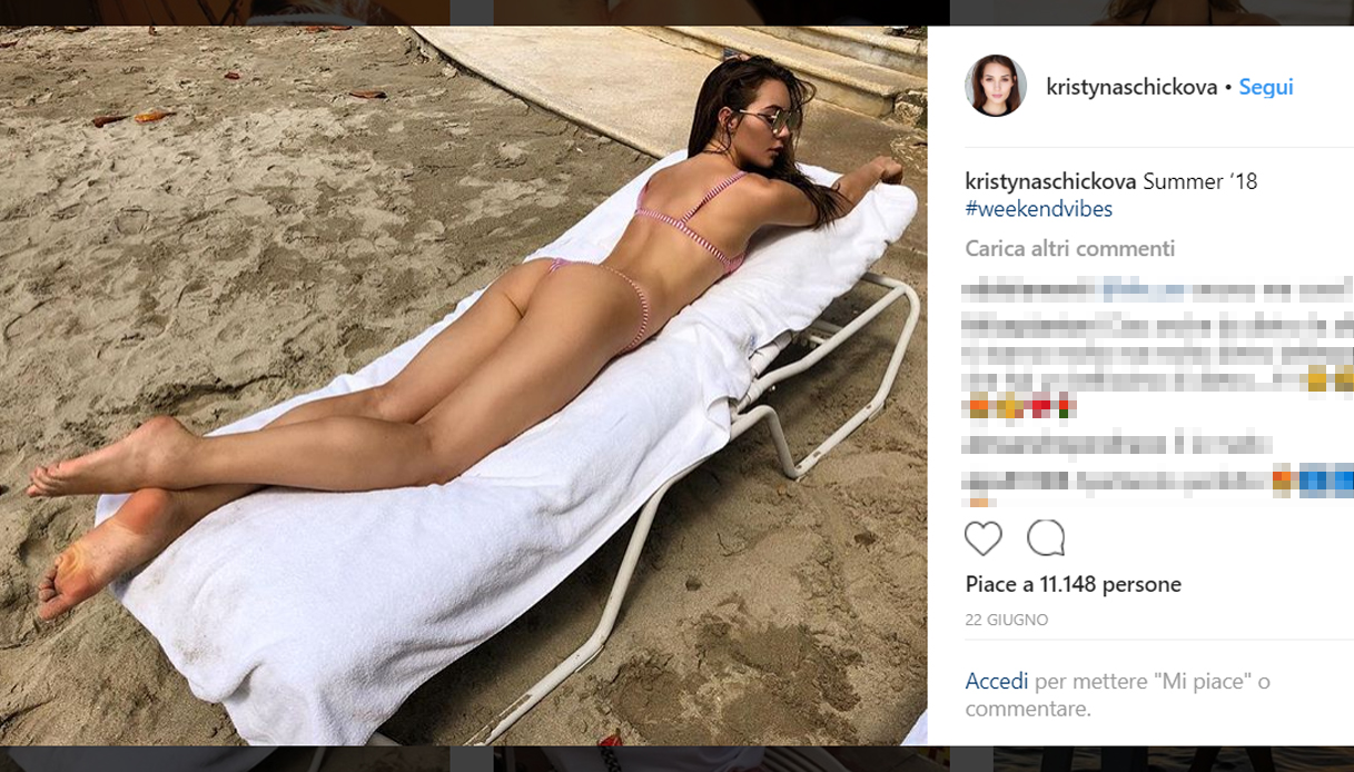 La sorella di Schick crea scandalo su Instagram