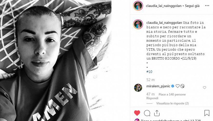 Claudia Lai Nainggolan si mostra rasata. E parla della malattia