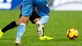 Dramma per l'ex Lazio Poborsky: malato per colpa della barba