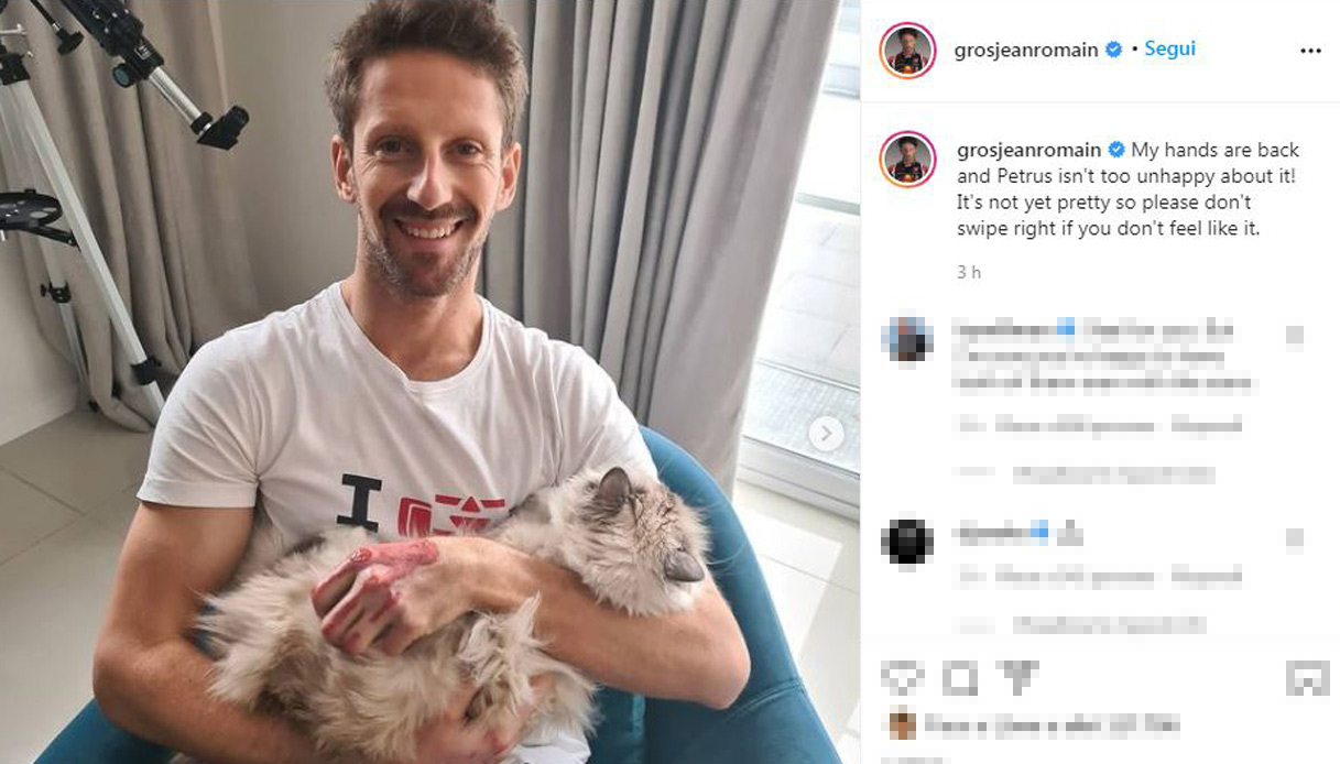 F1: Grosjean pubblica le foto delle ustioni sui social