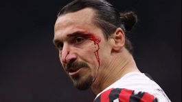 Ibra insanguinato dopo scontro con Medel: Milan-Bologna immagine choc