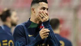 Juve, il lodo di Ronaldo diventa un rebus e CR7 finisce nei guai per i trapianti di capelli