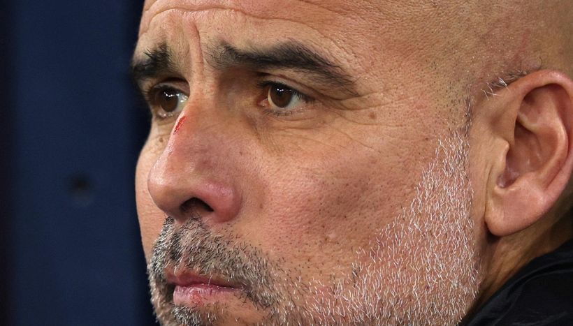 Guardiola si presenta davanti ai media con segni e graffi su viso e capo, poi fornisce la sua ricostruzione in diretta