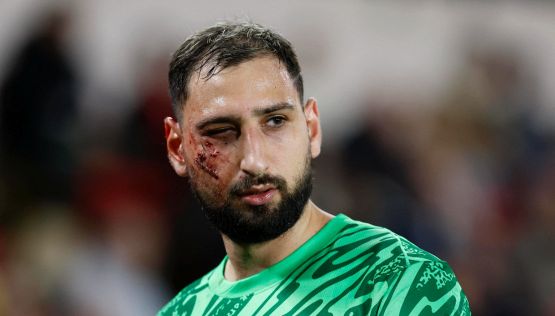 Donnarumma, il volto tumefatto e la reazione dei tifosi del Milan. Polemiche per il mancato rosso a Singo