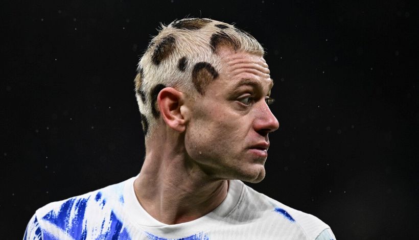 Norvegia, assurdo taglio capelli Ryerson non è una malattia: retroscena sulla chioma leopardata, a chi si è ispirato