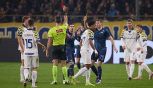 Parma-Lazio, moviola: abbaglio dell’arbitro, due rossi e tante risse