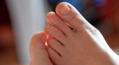 Avere peli su dita dei piedi e delle mani? Ecco cosa sta a significare