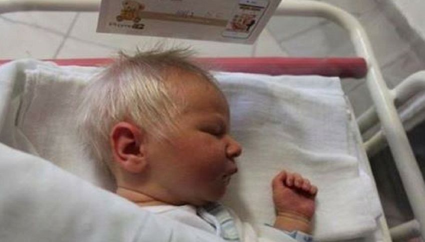 In Ungheria è nato un bambino con i capelli bianchi