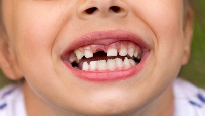 Perché quando cade il dentino arriva la fatina o il topolino a portare soldini?