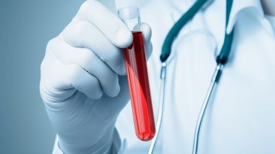 L'esame del sangue che 'prevede' l'infarto