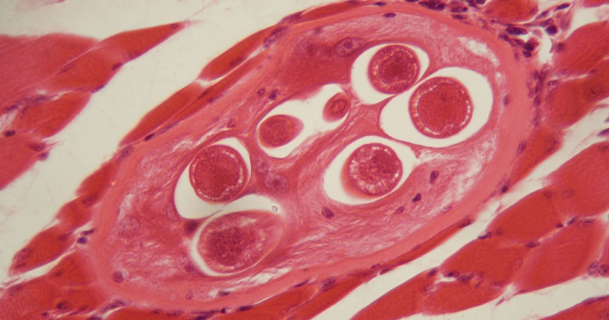 La nuova malattia infettiva che si