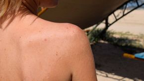 Abbronzatura perfetta dopo la spellatura: cosa (non) devi fare