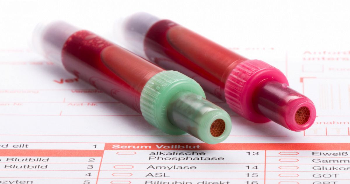 Blood Markers for Longevity: Can They Predict a Long and Healthy Life?