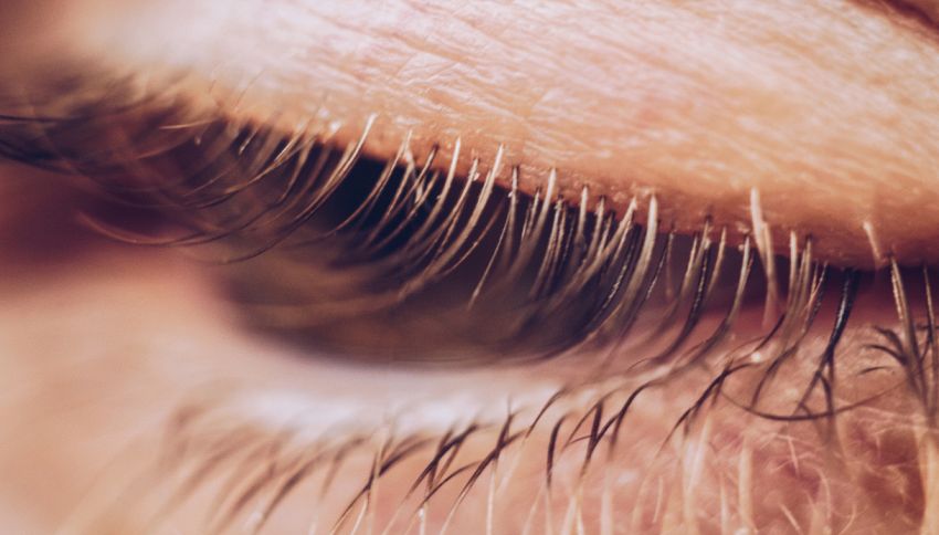 Vivono tra le tue ciglia e si accoppiano mentre dormi: questi microscopici acari potrebbero essere la causa dei tuoi occhi irritati