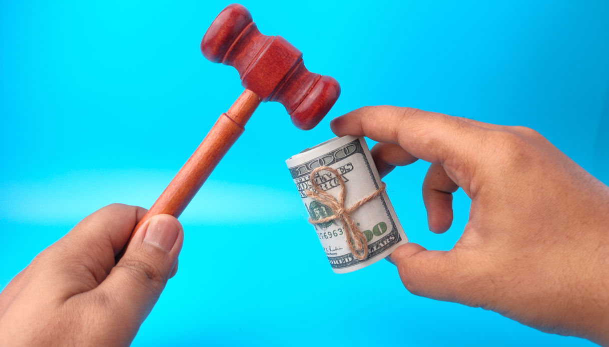 Una star di Hollywood ha venduto il suo calcolo renale: la cifra pagata dal suo fan &egrave; assurda