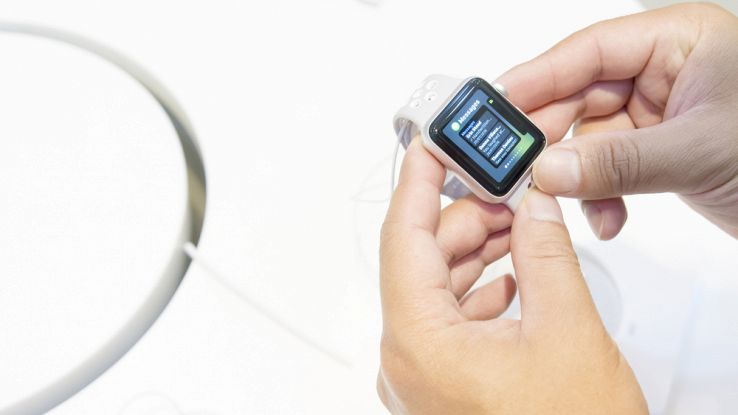 Apple Watch, 35 nuovi brevetti per stravolgere lo smartwatch