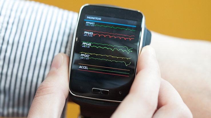Lo smartwatch in grado di scoprire se sei felice, triste o ansioso