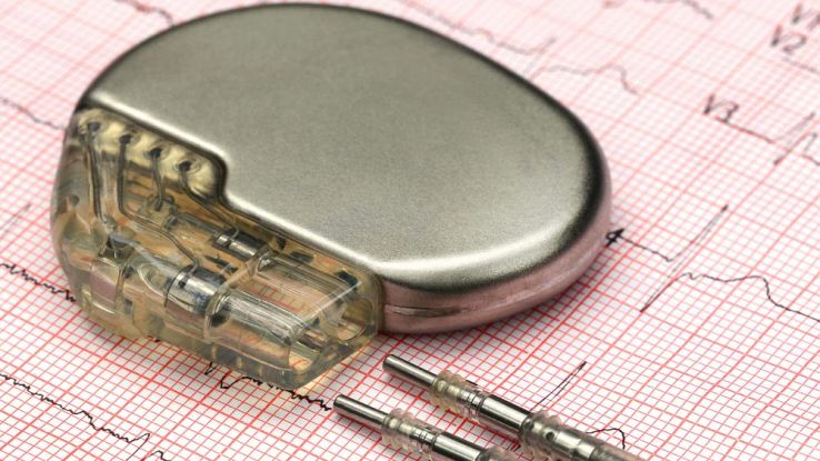 Allarme pacemaker: quasi 9000 falle di sicurezza informatica