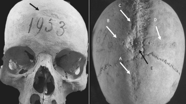 L'antico cranio