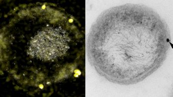 Hanno trovato un batterio che trasforma il metallo in oro