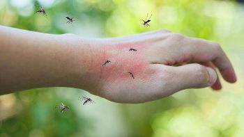 Gruppo di zanzare che punge una mano: cosa le attira?