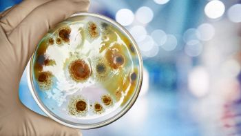 Scoperti in Veneto dei batteri mangia-PFAS