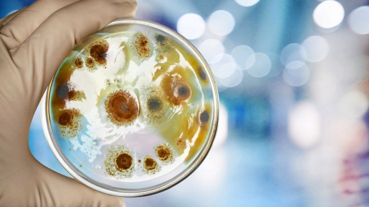 Scoperti in Veneto dei batteri mangia-PFAS