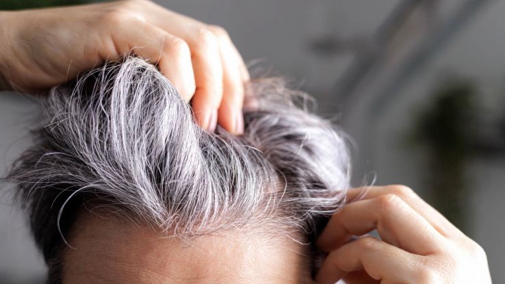 I capelli bianchi ci difendono dal cancro: la scoperta
