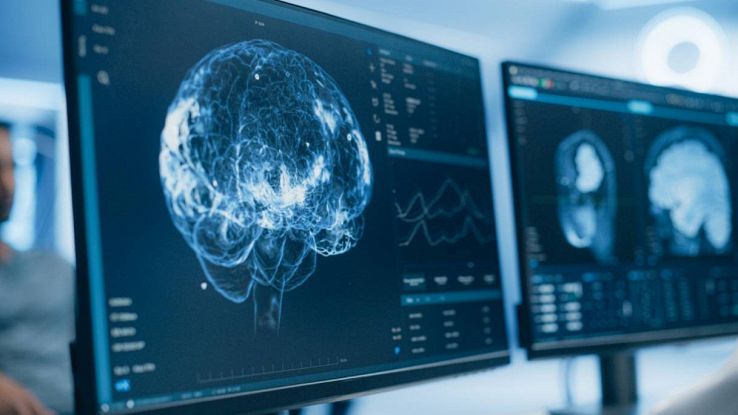 Un cervello virtuale in PC