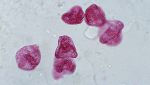 Microrganismi al microscopio