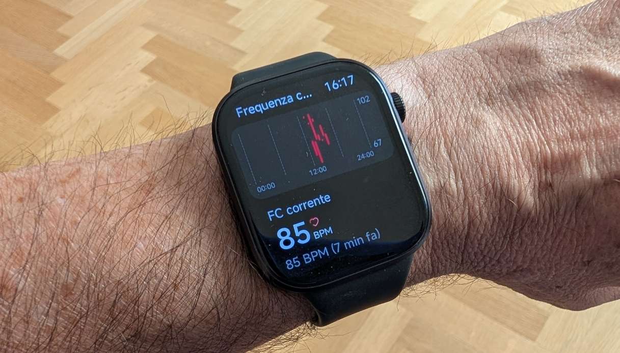 Redmi Watch 6