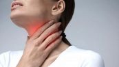 Calcoli tonsillari: come riconoscere i sintomi e come curarli