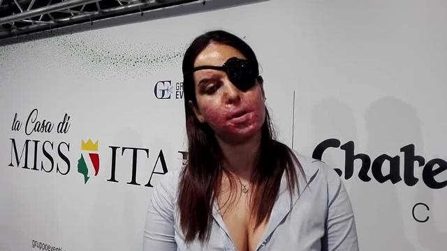 Miss Italia, Gessica Notaro: qui contro femminicidio