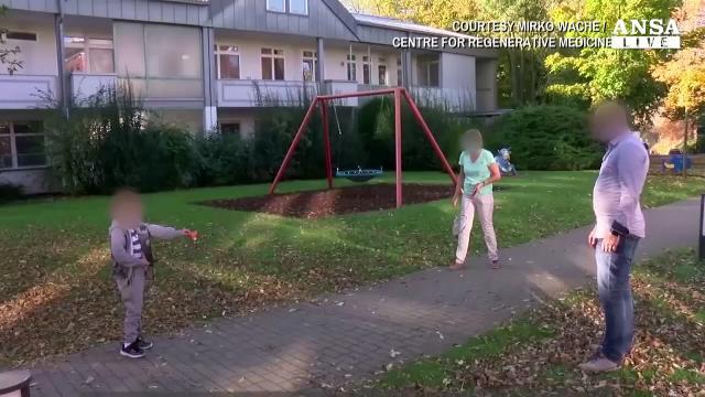 'Bambini farfalla', cos'e' l'epidermolisi bollosa