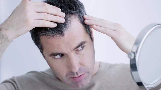 Perché certe persone diventano calve?