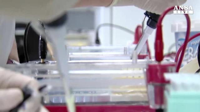 Nanorobot uccidono per fame 4 forme di tumore