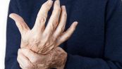 7 sintomi dell’artrite reumatoide da non sottovalutare