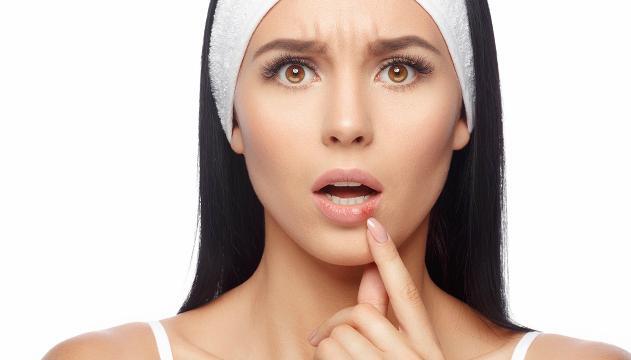 Curare l'herpes labiale con metodi naturali