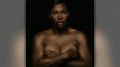 Serena Williams canta in topless contro il cancro