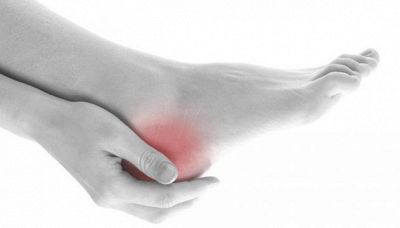 Tallonite: le cause, i sintomi e come curarla