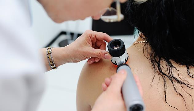 12 cattive abitudini che aumentano il rischio di cancro alla pelle