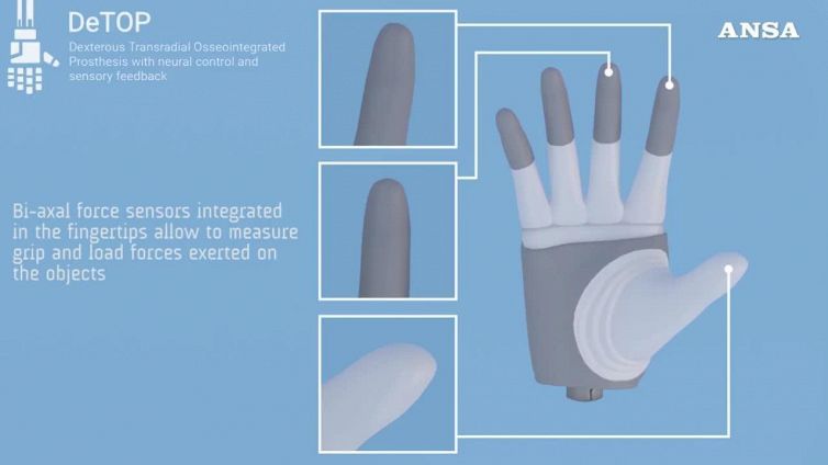 A una donna prima mano bionica 'per sempre'