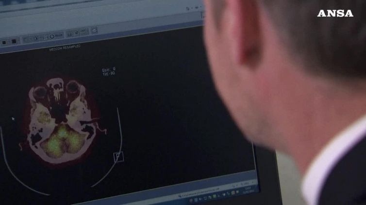 Italiano scopre 'interruttore del buon umore' nel cervello