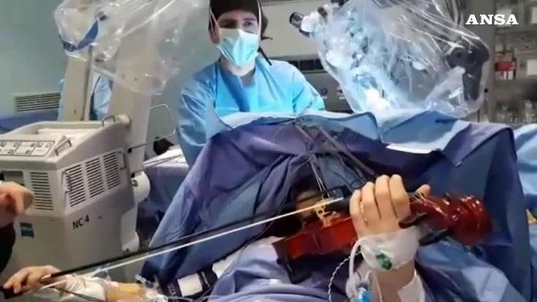 Musicista operata al cervello mentre suona violino
