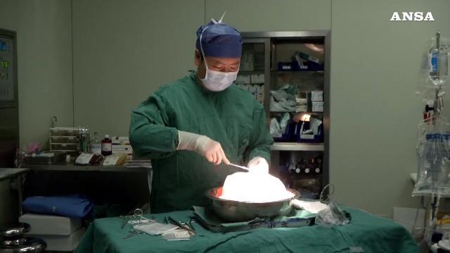 La bio-colla attivata dalla luce che ripara le ferite