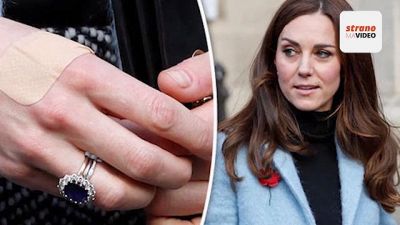 Perché Kate Middleton ha sempre i cerotti sulle mani?