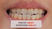 Perché i denti diventano gialli?