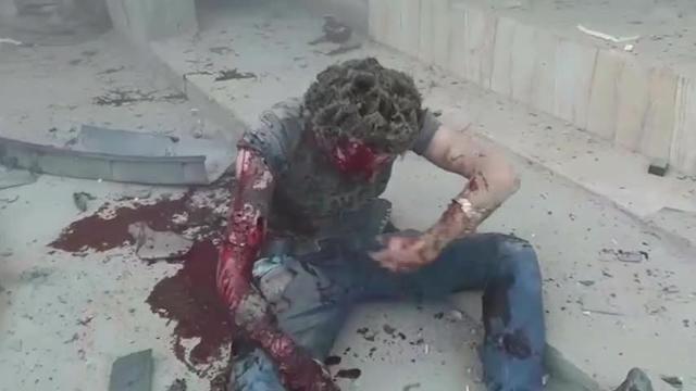 Siria: video shock su un 'raid turco' contro un convoglio